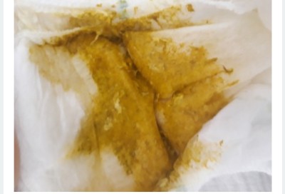 Bebek kaka resmi